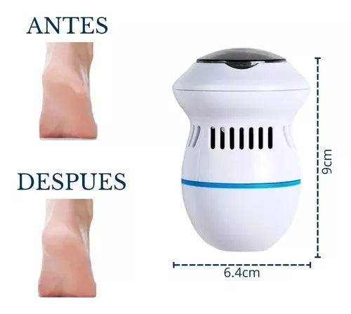 REMOVEDOR ELÉCTRICO DE CALLOS - RECUPERA LA SUAVIDAD DE TUS PIES
